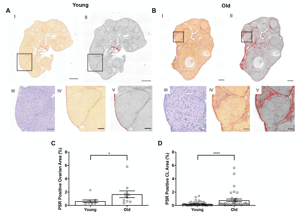 Collagen significantly increases in the whole ovary and around CLs in reproductively old mice. (A) Representative images depicting (I) PSR staining in a reproductively young ovary and (II) the same image in ImageJ software. (III) Representative image of an H&E-stained CL, (IV) the same CL with PSR staining, and (V) the CL in ImageJ. Scale bars are (I-II) 100 μm and (III-V) 25 μm. (B) Representative images of a reproductively old ovary and CL with the same histological techniques in (A). Scale bars are (I-II) 100 μm and (III-V) 25 μm. (C) Graph showing the percent of reproductively young and old ovaries positive for PSR (N = 10 ovaries per age group). A t-test was performed; asterisk denotes P = 0.019. (D) Graph showing analysis of the percent of PSR positive area in and surrounding CLs for both age cohorts. Each data point corresponds to one CL. A t-test was performed; asterisks denote P ± SEM (C and D).