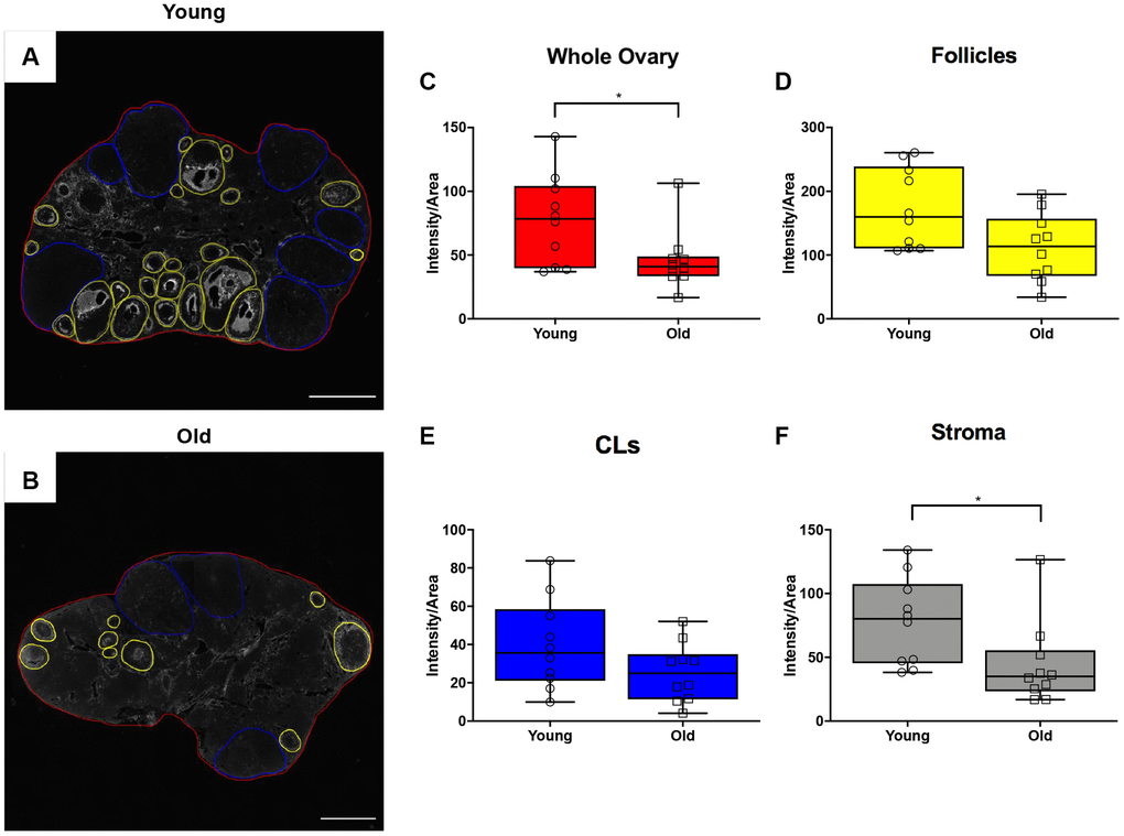 Hyaluronan significantly declines in the ovarian stroma of reproductively old mice. (A) Representative image of the hyaluronan binding protein (HABP) assay performed with reproductively young ovaries. The whole ovarian area is outlined in red. Follicles are outlined in yellow. CLs are outlined in blue. (B) Representative image of the HABP assay performed on reproductively old ovaries with the same ovarian sub-compartments outlined. Scale bars are (A, B) 200 μm. Graphs showing hyaluronan as intensity per area within (C) whole ovaries, (D) follicles, (E) CLs, and (F) the ovarian stroma between age cohorts. T-tests were performed; asterisks indicate significant differences (C: P = 0.043; F: P = 0.012). Data are represented as mean ± SEM (C–F). N = 10 ovaries per age group.