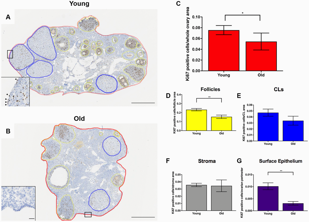 Cell proliferation is reduced post-ovulation in reproductively old mice. (A) Representative image of IHC labeling Ki67 in reproductively young ovaries. The whole ovarian area is outlined in red. Follicles are outlined in yellow. CLs are outlined in blue. (B) Representative image of IHC labeling Ki67 in reproductively old ovaries with the same ovarian sub-compartments outlined. Insets depict the boxed region of the OSE in each respective image. Scale bars are (A, B) 500 μm and (insets) 25 μm. Graphs showing the number of Ki67 positive cells per sub-compartment are within (C) whole ovaries, (D) follicles, (E) CLs, (F) the ovarian stroma, and (G) the OSE. T-tests were performed; asterisks indicate significant differences (C: P = 0.0294; D: P = 0.0091; G: P = 0.0023). Data are represented as mean ± SEM (C–G). N = 5 ovaries per age group.