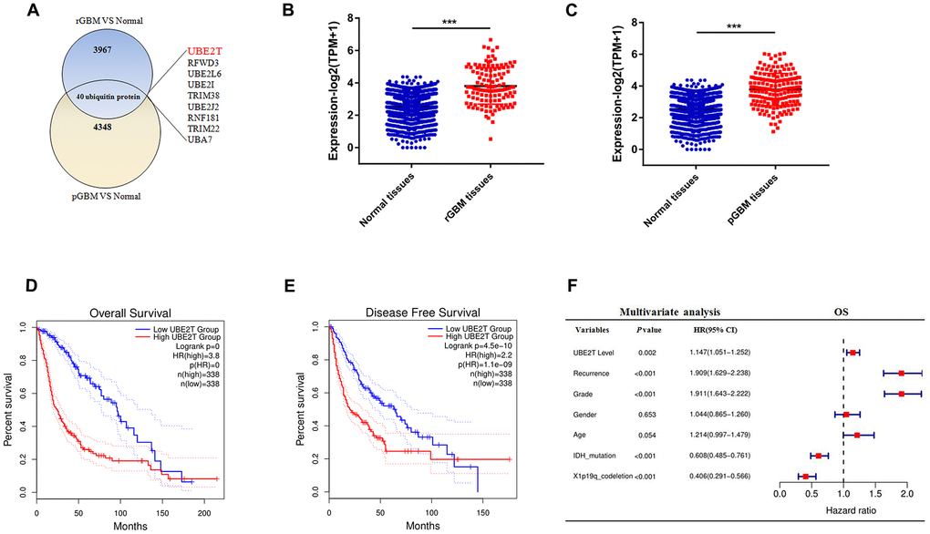 Ubiquitin-conjugating enzyme E2T (UBE2T) is an independent risk factor for gliomas. (A) Overlapping differentially expressed genes of recurrent and primary glioblastoma (GBM) compared with the findings in normal brain tissues. (B) UBE2T expression in recurrent GBM and normal tissues from the Genotype-Tissue Expression Project (GTEx) and Chinese Glioma Genome Atlas (CGGA) databases. (C) UBE2T expression in primary GBM and normal tissues from the GTEx and CGGA databases. (D) Overall survival analysis according to UBE2T expression in glioma using the GEPIA tool. (E) Disease-free survival analysis according to UBE2T expression in glioma using the GEPIA tool. (F) Multivariate analysis of the relationship of UBE2T with overall survival in glioma using the CGGA RNA sequencing dataset.