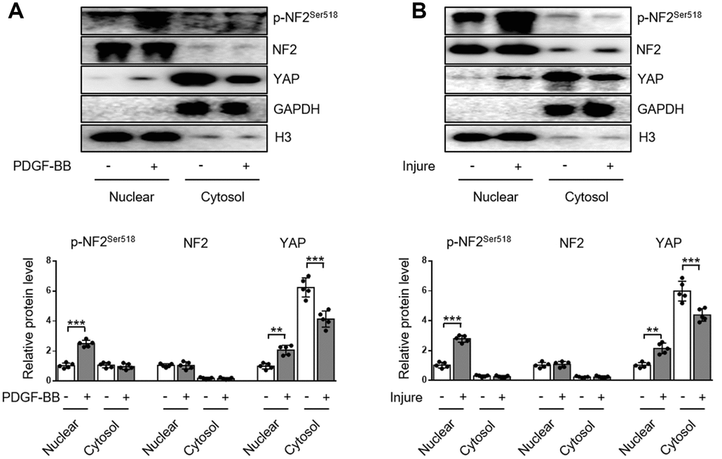 Enhanced NF2 phosphorylation and subsequent nuclear translocation of YAP following PDGF-BB treatment or injury. (A) Nuclear and cytosolic-enriched fractions were prepared from VSMC, which was treated by PDGF-BB (30 ng/mL) for 48 h. The relative protein expression levels of p-NF2Ser518, NF2 and YAP were determined by immunoblotting (n=5). (B) Nuclear and cytosolic-enriched fractions were prepared from arteries of C57BL/6J mice at day 28 after vascular injury. The relative protein expression levels of p-NF2Ser518, NF2 and YAP were determined by immunoblotting (n=5). Data are shown as mean ± S.D. **PP