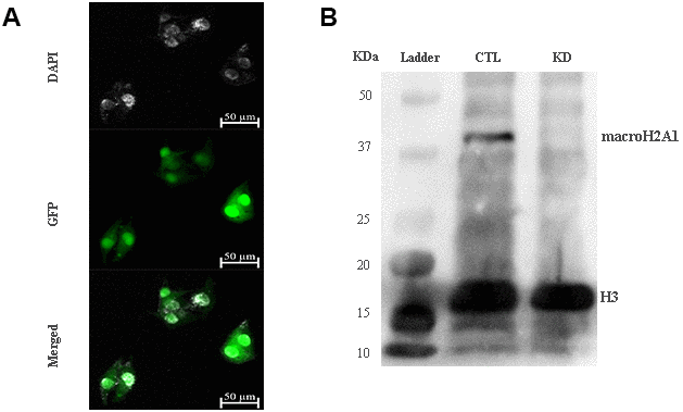 macroH2A1 silencing (knock-down, KD) in UM 92.1 cells. (A) Cells were infected with a lentivirus bearing a bicistronic construct expressing GFP and a macroH2A1-silencing shRNA. Control cells (CTL) were infected with lentivirus bearing a bicistronic construct expressing GFP and a scramble shRNA (data not shown). (B) Western blot analysis showed a significant reduction of macroH2A1 in transfected cells.