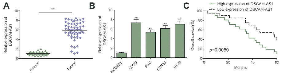 DSCAM-AS1 was upregulated and correlated with poor prognosis in patients with CRC. (A) qRT-PCR shows the lncRNA DSCAM-AS1 expression level in 56 pairs CRC tissues and non-tumor tissues. (B) qRT-PCR shows the lncRNA DSCAM-AS1 expression level in a normal human colon epithelial cell line NCM460 and four human CRC cell lines (LOVO, PKO, SW480 and HT29).(C) 56 patients with CRC were divided into two groups based on a median DSCAM-AS1 value and the association of DSCAM-AS1 expression with overall survival was analyzed with a Kaplan–Meier plot. P P 