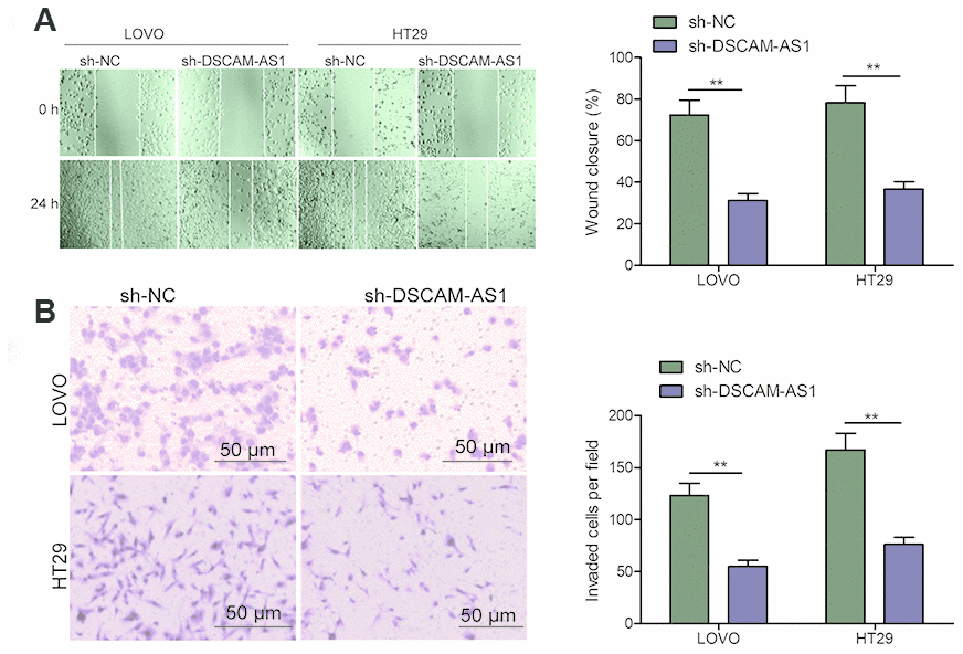 Knockdown of DSCAM-AS1 inhibits migration and invasion of CRC cells. (A) Cell migration was examined in LOVO and HT29 cells transfected with sh-NC or sh-DSCAM-AS1 by wound healing assay. (B) Cell invasion was examined in LOVO and HT29 cells transfected with sh-NC or sh-DSCAM-AS1 by transwell invasion assay. P P 