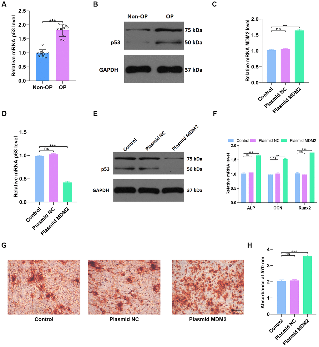 MDM2-mediated p53 degradation induces osteoblast differentiation in vitro. (A, B) p53 levels in non-OP patients and OP patients were measured by qRT-PCR and western blot; n=10 per group. (C) MDM2 expression in hMSCs was assessed by qRT-PCR analysis after different treatments. (D–E) p53 levels were measured by qRT-PCR and western blot in the three groups. (F) Osteogenic gene levels were measured by qRT-PCR. (G–H) Alizarin red-mediated calcium staining in hMSCs 21 days after transfection with different constructs. Scale bar = 10mm. Data are means ± SD. *p 