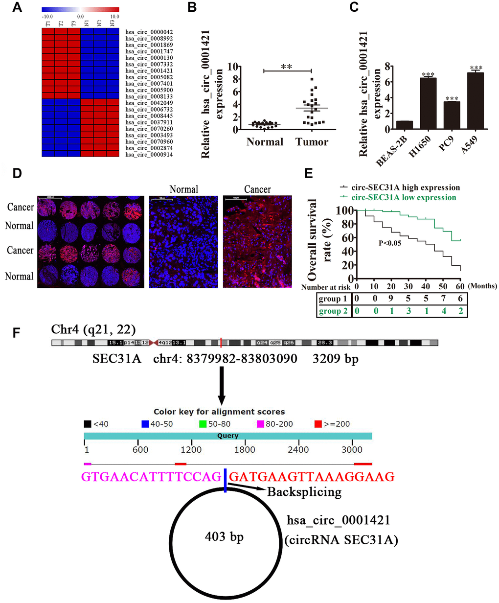 The expression of circ-SEC31A predicted an unfavorable prognosis in non-small cell lung cancer (NSCLC) patients. (A) Heat map of all differentially-expressed circRNAs between normal and tumor tissues. (B) RT-qPCR showing the relative expression of the circ-SEC31A from 20 NSCLC tumor tissues and adjacent non-tumor tissues. Data are presented as mean ± SD; **pC) RT-qPCR detection showing the relative expression of circ-SEC31A in A549, PC9, H1650, and normal lung epithelial cells (BEAS-2B). Data are presented as mean ± SD; ***PD) The expression of circ-SEC31A in NSCLC was analyzed by in situ hybridization on a NSCLC tissue chip (90 cases). (E) Prognostic significance of circ-SEC31A expression for NSCLC patients was performed with FISH values by using the median value as the cut-off; the observation time was 60 months. (F) The genomic loci of the SEC31A gene and circ-SEC31A. N, non-tumor tissues; T, tumor tissues.