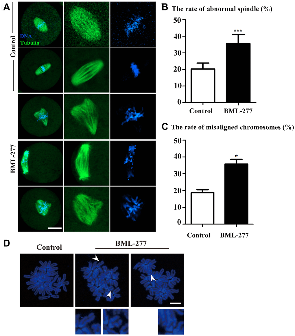 CHK2 inhibition affected spindle morphology and chromosome alignment at the first cleavage of early mouse embryos. (A) Embryos at metaphase were stained with anti-α-tubulin (green) and counterstained with Hoechst 33342 to visualize chromosomes (blue). Unlike those in the control group, embryos in the 25 μM treatment group showed a variety of defects, including multipolar and nonpolar spindles. The chromosomes in embryos in the 25 μM treatment group were severely misaligned. Bar = 20 μm. (B) A significantly higher proportion of embryos in the 25 μM treatment group exhibited spindle defects than those in the control group (35.5 ± 5.51%, n = 173 vs. 20.3 ± 3.55%, n = 165, p C) The incidence of chromosome misalignment was also higher in embryos in the 25 μM treatment group than in those in the control group (35.8 ± 2.80%, n = 81 vs. 18.7 ± 1.82%, n = 55, p p D) Chromosomal aberrations were observed in embryos in the CHK2 inhibition group. Blue, DNA. Bar = 5 μm.