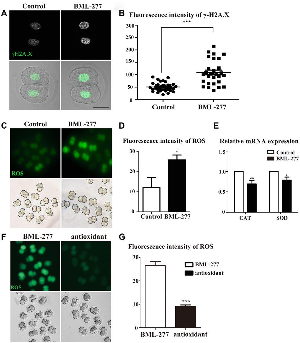 CHK2 inhibition affected DNA damage and oxidative stress during early embryonic development in mice. (A) Embryos at the 2-cell stage were stained with anti-γ-H2A.X (green). The γ-H2A.X signal was stronger in embryos in the CHK2 inhibition group. Bar = 30 μm. (B) The fluorescence intensity of γ-H2A.X in embryos in the 25 μM and control groups (108.8 ± 9.46, n = 28, 25μM vs. 50.7 ± 3.05, n = 32, control, p C) Embryos at the 2-cell stage were stained for ROS (green). The ROS signal was stronger in embryos in the CHK2 inhibition group. (D) The fluorescence intensity of ROS in embryos in the 25 μM treatment group and control group (25.9 ± 2.41, n = 43, 25 μM vs. 12.2 ± 5.0, n = 33, control, p E) The expression of ROS-related genes in the 25 μM group and control group. (F) The ROS signal of embryos in the CHK2 inhibition group decreased after supplementation with an antioxidant. (G) ROS fluorescence intensity analysis. ***significant difference (p 