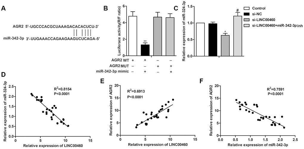 Knockdown of LINC00460 suppresses AGR2 expression by targeting miR-342-3p. (A) Bioinformatics prediction showed the complementary sequence between AGR2 and miR-342-3p. (B) The targeting relationship between AGR2 and miR-342-3p was further verified by the luciferase reporter assay. (C) Relative expression of AGR2 was detected through qRT-PCR. (D–F) The trend lines between the level of LINC00460, AGR2 and miR-342-3p. *P **P #P 