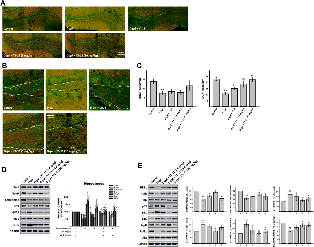 Effect of T1-11 on neurogenesis markers in hippocampus of D-gal-induced aging mice. Hippocampal neurogenesis was detected by immunohistochemical staining with double cortin (DCX, red) and BrdU antibody (green). The full representative immunostaining images and partial enlargement of the dentate gyrus (DG) area are shown in (A, B). (C) The number/mm SGZ of BrdU positive cells (BrdU+) and DCX positive cells (DCX+) are counted. Western blot analysis of (D) neuron aging related molecules and (E) cellular senescence markers. Data are mean±SEM (n = 6). Significant difference between control and D-gal-induced aging mice is indicated by * p p p p 