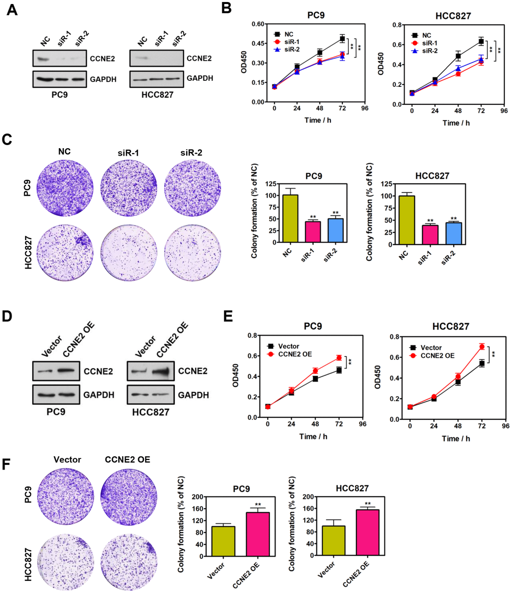 CCNE2 promotes NSCLC cell proliferation in vitro. (A) The knockdown of CCNE2 by siRNAs in PC9 and HCC827 cells was verified by Western blot. GAPDH was used as loading control. (B) Cell proliferation abilities of CCNE2-depleted PC9 and HCC827 cells were assessed by CCK-8 assays. The data were presented as means ± SDs of three independent experiments; **P C) Colony-formative abilities of CCNE2-depleted PC9 and HCC827 cells were determined by colony-formation assays. Right panel, the relative colony-formative abilities (% of NC) were quantified. The data were shown as means ± SDs of three independent experiments; **P D) Overexpression of CCNE2 in PC9 and HCC827 cells was examined by Western blot. GAPDH was used as loading control. (E) Cell proliferation capacities of CCNE2-overexpressed PC9 and HCC827 cells were assessed by CCK-8 assays. The data were presented as means ± SDs of three independent experiments; **P F) Colony-formative abilities of CCNE2-overexpressed PC9 and HCC827 cells were determined by colony-formation assays. Right panel, the relative colony-formative abilities (% of NC) were quantified. The data were shown as means ± SDs of three independent experiments; **P 