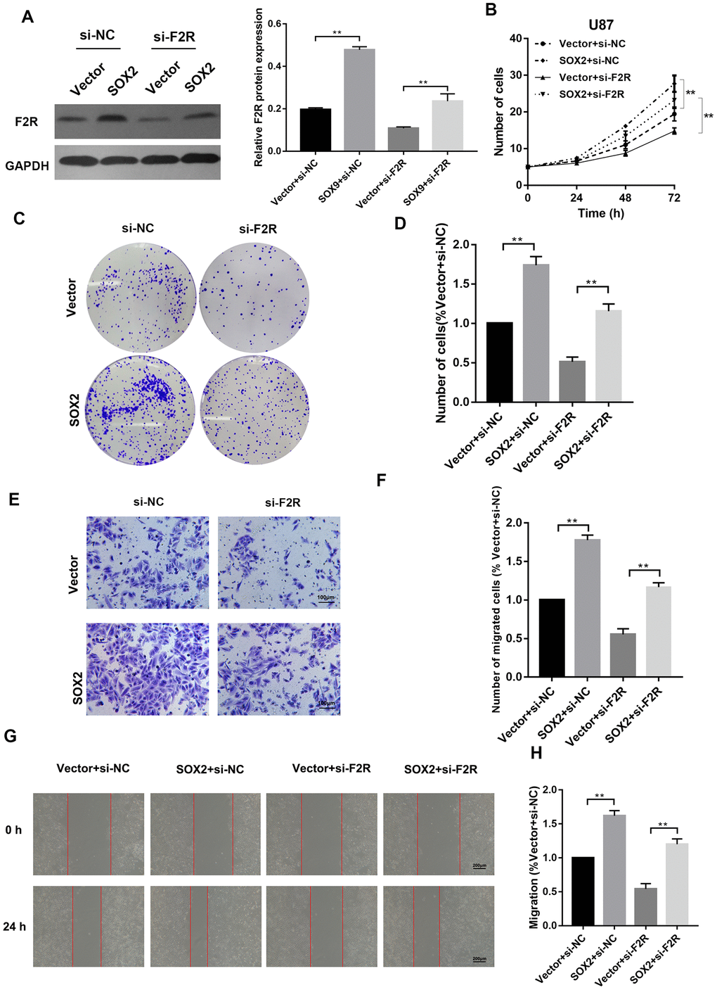 F2R is a functional target of SOX2 in glioma cells. SOX2 plasmid and si-F2R were co-transfected into U87 and U251 cells. (A) Western Blot analysis of protein level of F2R. (B) Cell proliferation assay detecting the proliferation rate. (C, D) Colony formation assays. (E, F) Transwell invasion assay. (G, H) Wound healing assay. All experiments were repeated at least three times. Data are means ± SEM. **P