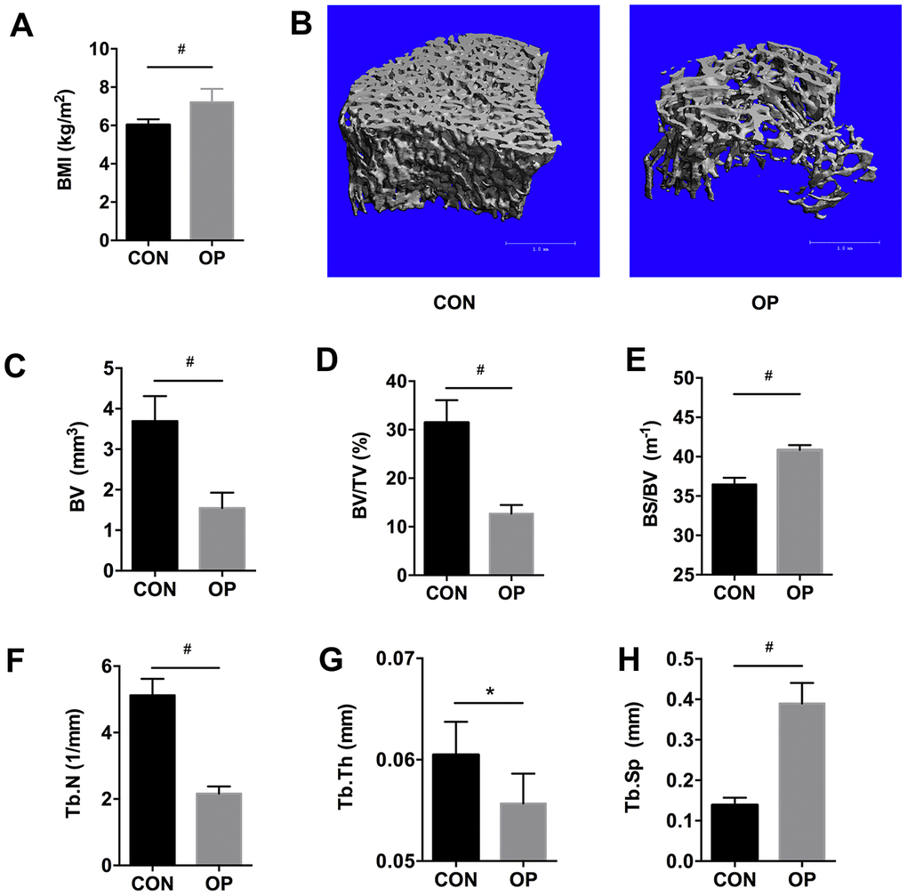 BMI, micro-CT based three-dimensional images and histomorphometry in aged female SD rats. BMI (A), three-dimensional reconstruction (B), bone volume (BV), bone surface density (BV/TV), ratio of bone surface area to bone volume (BS/BV), trabecular number (Tb.N), trabecular thickness (Tb.Th), and trabecular spacing (Tb.Sp) using micro-CT scanning (C–H). Results were compared by unpaired t test with Welch’s correction, *P 