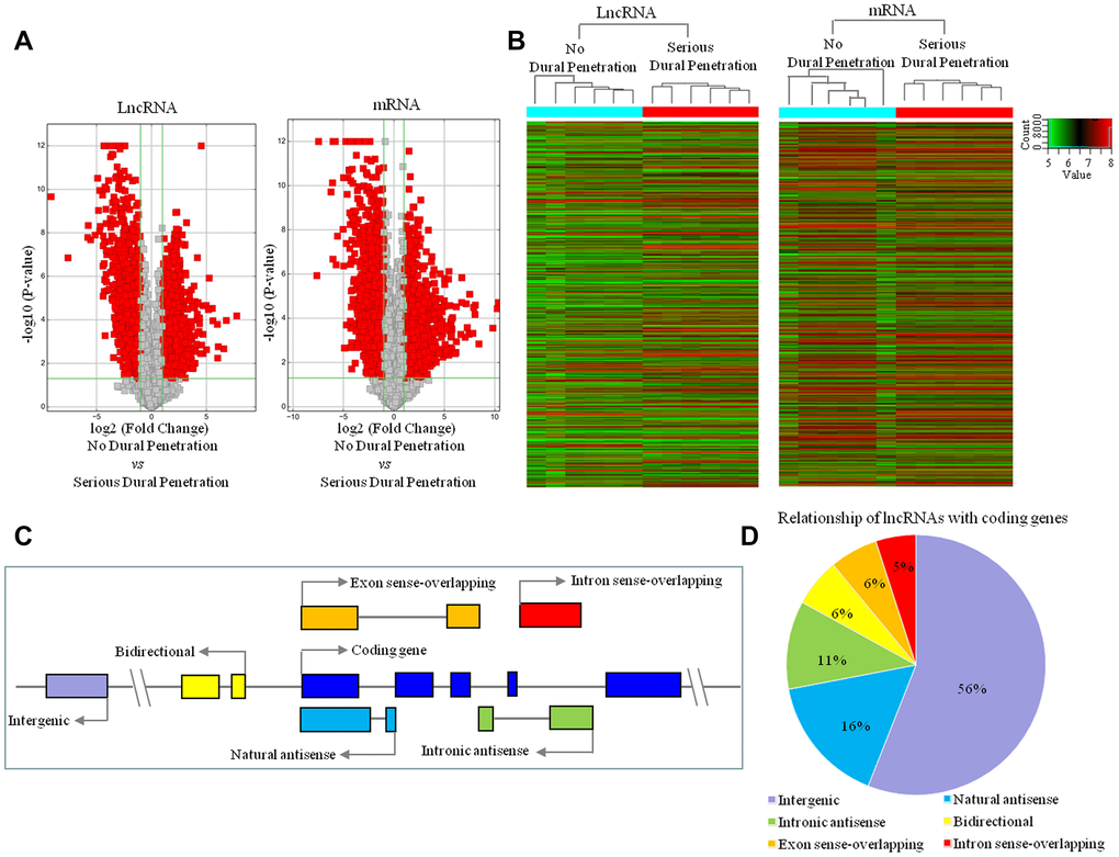 LncRNA and mRNA expression profile changes between serious dural penetration and no-dural penetration in chordoma. (A) Volcano plot analysis of 2760 lncRNAs and 3988 mRNAs that are differentially expressed between no dural penetration group and serious dural penetration group; and red boxes represent ≥ 2-fold change difference and P ≤ 0.05. (B) Hierarchical clustering of all samples revealed the nonrandom partitioning of samples into two major groups: one group containing six no dural penetration samples and another group containing six serious dural penetration samples. Each column represents one sample and each row represents one lncRNA or mRNA probe set. (C) Transcriptional patterns of lncRNAs. Nature antisense: the lncRNA is transcribed from the antisense strand and overlapping with a coding transcript; Intronic antisense: the lncRNA is transcribed from the antisense strand without sharing overlapping exons; Intron sense-overlapping: the lncRNA is overlapping the intron of a coding transcript on the same genomic strand; Exon sense-overlapping: the lncRNA is overlapping the exon of a coding transcript on the same genomic strand; Intergenic: there are no overlapping or bidirectional coding genes nearby the lncRNA; Bidirectional: the lncRNA is oriented head to head to a coding gene within 1000 bp. Arrow represent transcription direction. (D) Subgroup analysis of altered lncRNAs in relation to their nearby coding genes.