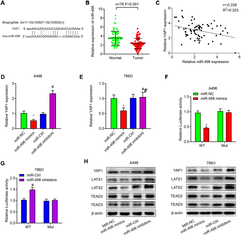 MiR-498 suppresses YAP1 expression by directly binding to the YAP1 mRNA 3’UTR. (A) The putative binding sites of miR-498 in YAP1 3’-UTR region were predicted. (B) Relative expression of miR-498 in 76 paired ccRCC tissues. (C) miR-498 was inversely correlated with the expression of miR-498 (r = −0.405, PD, E) Relative expression of YAP1 mRNA in A498 and 786O cells transfected with miR-NC, miR-498 mimics, miR-Ctrl or miR-498 inibitors. (F, G) A498 and 786O cells were transfected with YAP1 wild type reporter or mutant reporter constructs together with miR-498 mimics or inhibitors, and the luciferase activity was analyzed. (H) Western blot analysis of Hippo signaling pathway (YAP1, LATS1, LATS2, TEAD2 and TEAD3) in A498 and 786O cells transfected with miR-NC, miR-498 mimics, miR-Ctrl or miR-498 inibitors. * P