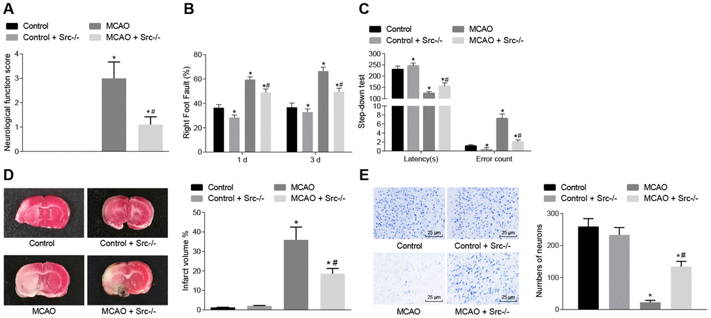 Knockout of the Src gene alleviates cerebral infarction, and improves neuron functions and learning and memory abilities in MCAO mice. (A) neurological function score of Src-/- mice. (B) rate of left limb fault step in Src-/- mice in the foot-fault test; (C) latency period and number of errors of Src-/- mice during the step-down test; (D) the volume of infarct in Src-/- mice after TTC staining; (E) the number of neurons in Src-/- mice using Nissl staining (× 400). Measurement data are expressed as mean ± standard deviation and compared using one-way ANOVA, followed by Tukey's post hoc test. * p vs. control group (sham-operated wild-type mice); # p vs. MCAO group (wild-type mouse models of MCAO). N = 15.