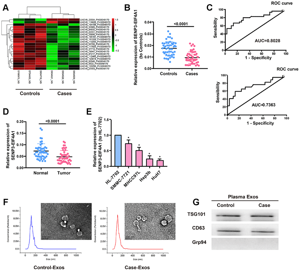 Expression of plasma exosomal SENP3-EIF4A1 in patients with HCC. Exosomes (exos) are isolated from the plasma of HCC patients and healthy controls. (A) Heatmap illustrating the 21 differentially expressed lncRNAs between HCC patients’ plasma exos and healthy control patients’ plasma exos. (B) Detection of SENP3-EIF4A1 in exos from plasma via qRT-PCR. (C) Receiver Operating Characteristic (ROC) curve for the SENP3-EIF4A1 to distinguish HCC cases from controls (Top). Receiver Operating Characteristic (ROC) curve for the SENP3-EIF4A1 to distinguish TNM I/II stage HCC cases from controls (bottom). (D) Determination of SENP3-EIF4A1 in tumor tissues and adjacent normal tissues via qRT-PCR. (E) SENP3-EIF4A1 is lowly expressed in HCC cells compared with HL-7702 cell line. (F) Micrographs and the size distribution of exos isolated from the plasma of HCC patients (left) and healthy controls (right) were detected using TEM (bars =200 nm) and NTA. (G) Detection of TSG101, CD63 and Grp94 in circulating exos via Western blotting. Results are shown as mean ± SD. *P