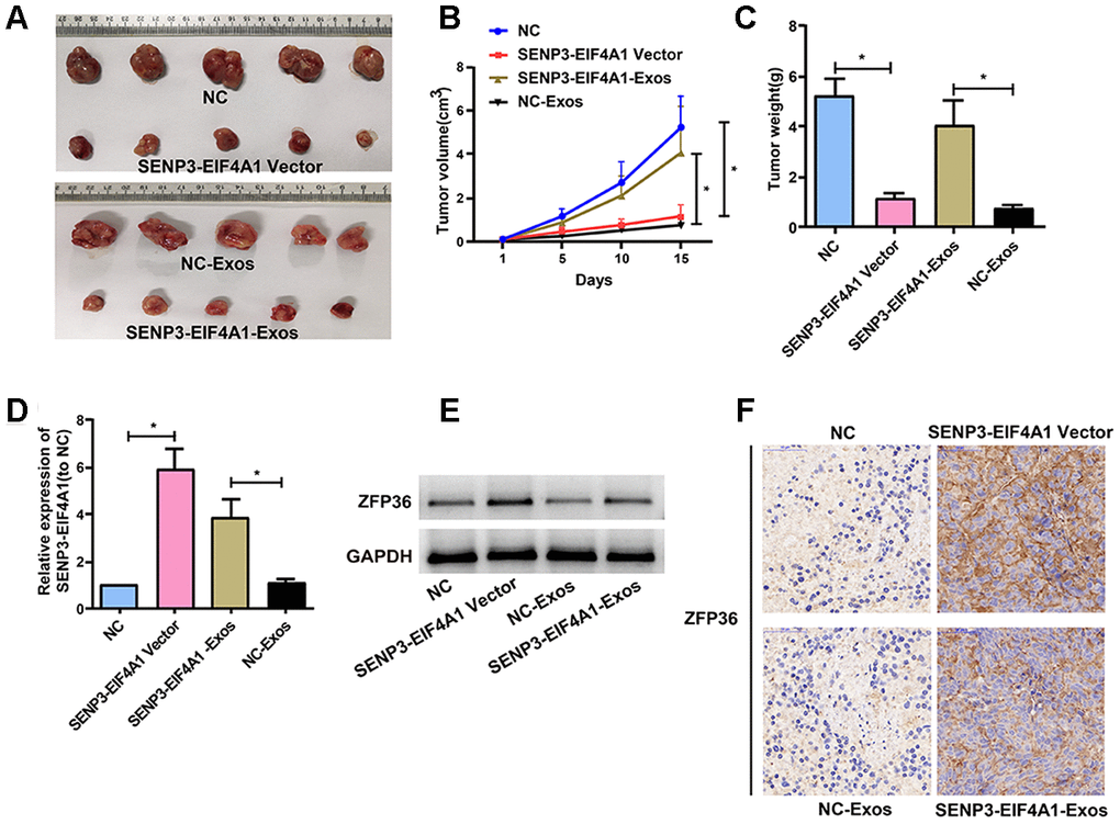 Effects of SENP3-EIF4A1 overexpression and exosomal SENP3-EIF4A1 on tumor in vivo. HuH7 cells are transfected with SENP3-EIF4A1/NC lentiviral vectors, namely SENP3-EIF4A1 vectors and NC, respectively. Exos are separated from HL-7702 cells transfected with SENP3-EIF4A1/NC lentiviral vectors, namely SENP3-EIF4A1-Exos and NC-Exos, respectively. (A) The xenografts from nude mice inoculated in NC, SENP3-EIF4A1-Exos, SENP3-EIF4A1 vectors and NC-Exos (n=5, each group). (B) The tumor volumes are measured every other day after injection. (C) Determination of the tumor weights in nude mice after 15 days. (D) Detection of SENP3-EIF4A1 expression in tumor tissues of nude mice treated with NC, SENP3-EIF4A1 vectors, SENP3-EIF4A1-Exos and NC-Exos by qRT-PCR. (E) Detection of ZFP36 in tumor tissues via Western blotting. (F) Analysis of ZFP36 expression in tumor tissues by IHC. Results are shown as mean ± SD. *P