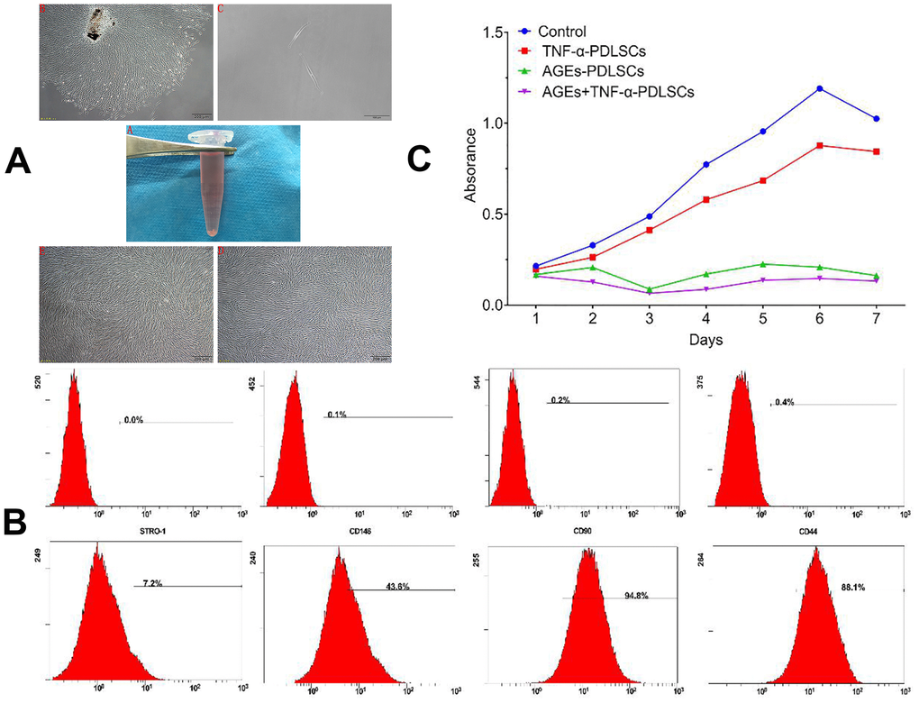 (A) A1 in vitro normal periodontal tissue; A2 Cells with irregular shape around the tissue block after seven days (40×); A3 primary cell monoclonal purification (40×); A4 first generation cells (40×); A5 third generation cells (40×). (B) PDLSCs phenotype identification PDLSCs exhibited positive expression of STRO-1, CD146, CD-90 and CD-44. (C) The effect of different stimuli on the proliferation of third generation PDLSCs by CCK-8 method.