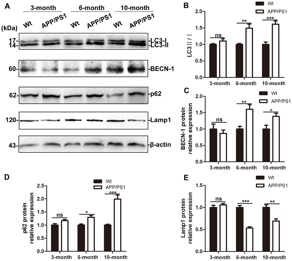 Autophagic flux in the brains of APP/PS1 DTg AD mice of ages. (A) Western blot showing LC3, BECN-1, p62 and Lamp1 expression in the brains of wild-type (Wt) and APP/PS1 DTg mice. (B–E) Relative gray density analysis of LC3-II/LC3-I, BECN-1, p62, and Lamp1 expression levels. The data are presented as the mean ± SEM and were analyzed by t test. (Compared with Wt mice, * P 