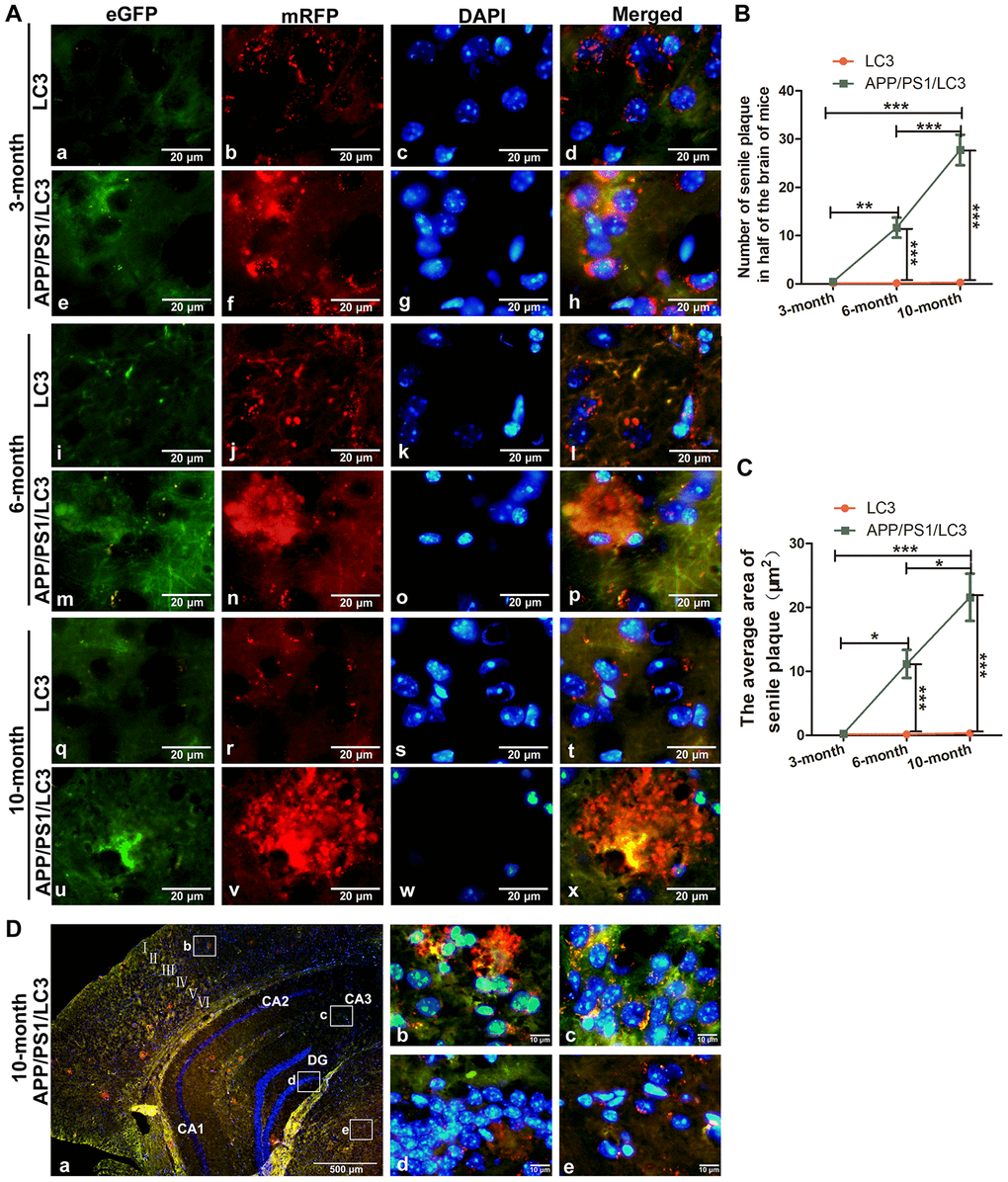 The co-existence of APs, ALs and SPs in the brains of APP/PS1/LC3 autophagic flux AD model mice. (A) In the brains of 3-month-old 3×Tg mice, the AP and AL proportion increased, but no SPs were found. In the brains of 6- and 10-month-old 3×Tg mice, SPs coexisted with APs and ALs. Scale bar = 20 μm. (B and C) The quantification of SPs in 3×Tg mice and littoral LC3 mice. (*P D) Autophagic flux in the different brain regions of 10-month-old 3×Tg mice. There were more APs but less ALs in the cortex and hippocampus, while there were less APs but more ALs in the white matter. Scale bar: a, 500 μm, b-e, 10 μm.