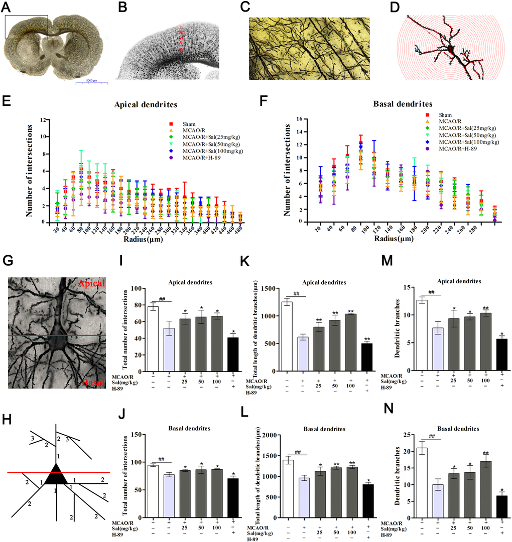 Sal promotes dendritic growth by upregulating the FGF2-mediated cAMP/PKA/CREB signaling pathway. (A, B) Representative coronal sections processed by Golgi staining methods after MCAO/R. (C, D) Example of a layer V pyramidal neuron (the scale bar is 20 μm). (G) Illustration of the demarcation between the apical (upper) and basal (lower) dendrites. (H) Dendritic segments are numbered in the proximal to distal direction from the soma. (E, F) Distribution of the dendritic intersections at an increasing distance from the soma. (I, J) Total number of intersections in each group. (K, L) Total length of dendritic branches. (M, N) Dendritic branches. Values are expressed as the mean ± SD. #p ##p *p **p 