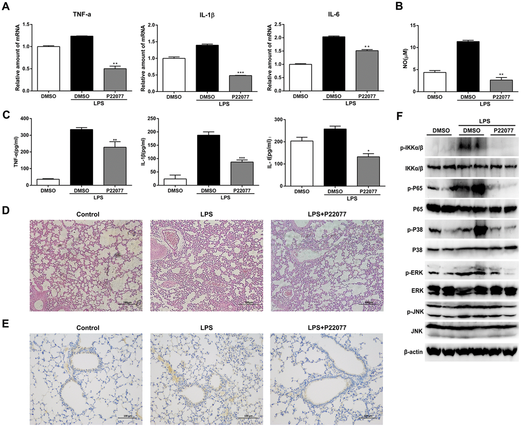 P22077 relieves LPS-induced inflammatory response in mice. C57BL/6 mice (10 mice/group) were intraperitoneally injected with DMSO or P22077 (15 mg/kg), following challenged with PBS or LPS (10 mg/kg). Mice were sacrificed after 2 h. (A) TNF-α, IL-1β and IL-6 mRNA level in lung tissue were analyzed by Q-PCR. (B) Nitric oxide (NO) concentrations in the serum were examined by Griess assay. (C) TNF-α, IL-1β and IL-6 concentrations in the serum were examined by ELISA. (D) Left lung was collected for HE staining, and representative images were displayed. Scale bars, 100 μm. (E) Left lung was collected for immunohistochemistry staining of TRAF6. Scale bars, 100 μm. (F) Lung tissue was grinded and centrifuged, and the supernatant was used to analyzed the indicated proteins by immunoblot. Similar results were obtained from three independent experiments and data were presented as mean ± SD of one representative experiment. *PA–C).