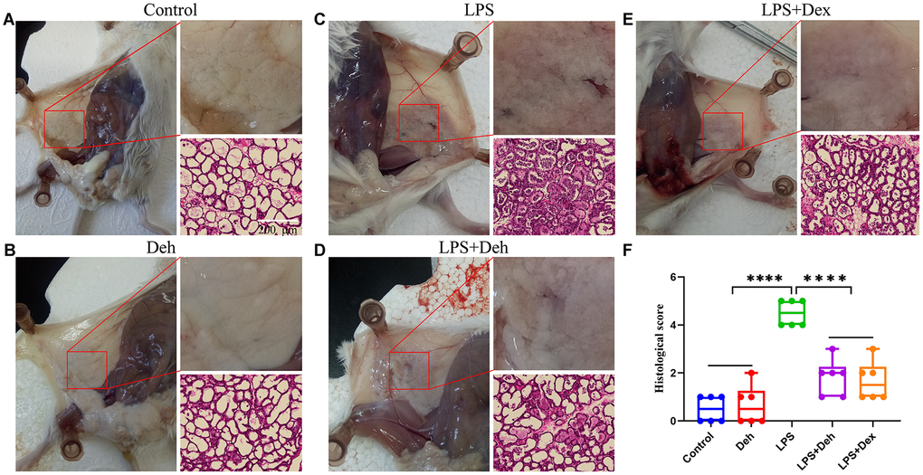 Dehydroandrographolide (Deh) alleviates LPS-induced mammary injury in mice. (A–E) The histological effect of Deh on LPS-induced mastitis in mice and the effect of Deh on neutrophil infiltration in the mouse mammary gland. (F) Histological score of the mouse mammary gland. The values are presented as the mean ± SD (*pppp