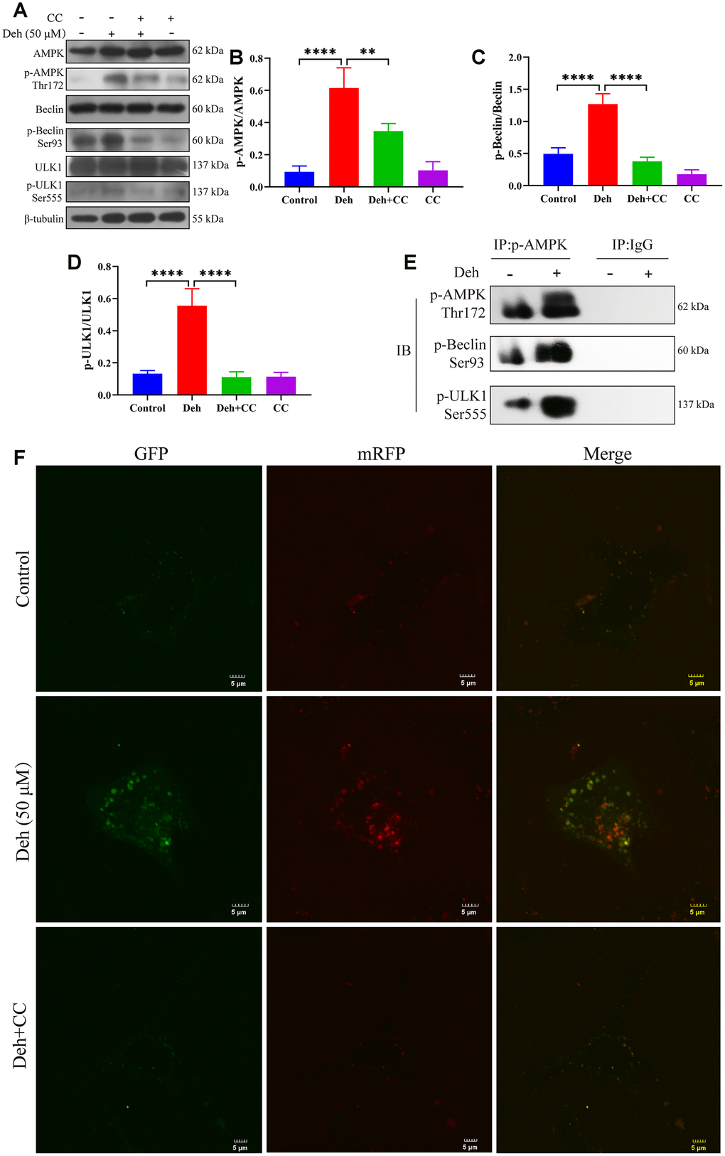 Deh activates autophagy through AMPK. (A–D) Protein levels of p-AMPK, AMPK, p-Beclin, Beclin, p-ULK1 and ULK1. (E) The interaction of p-AMPK with p-ULK1 and p-Beclin. (F) Deh affects autophagic flux through AMPK. The values are presented as the mean ± SD (*pppp