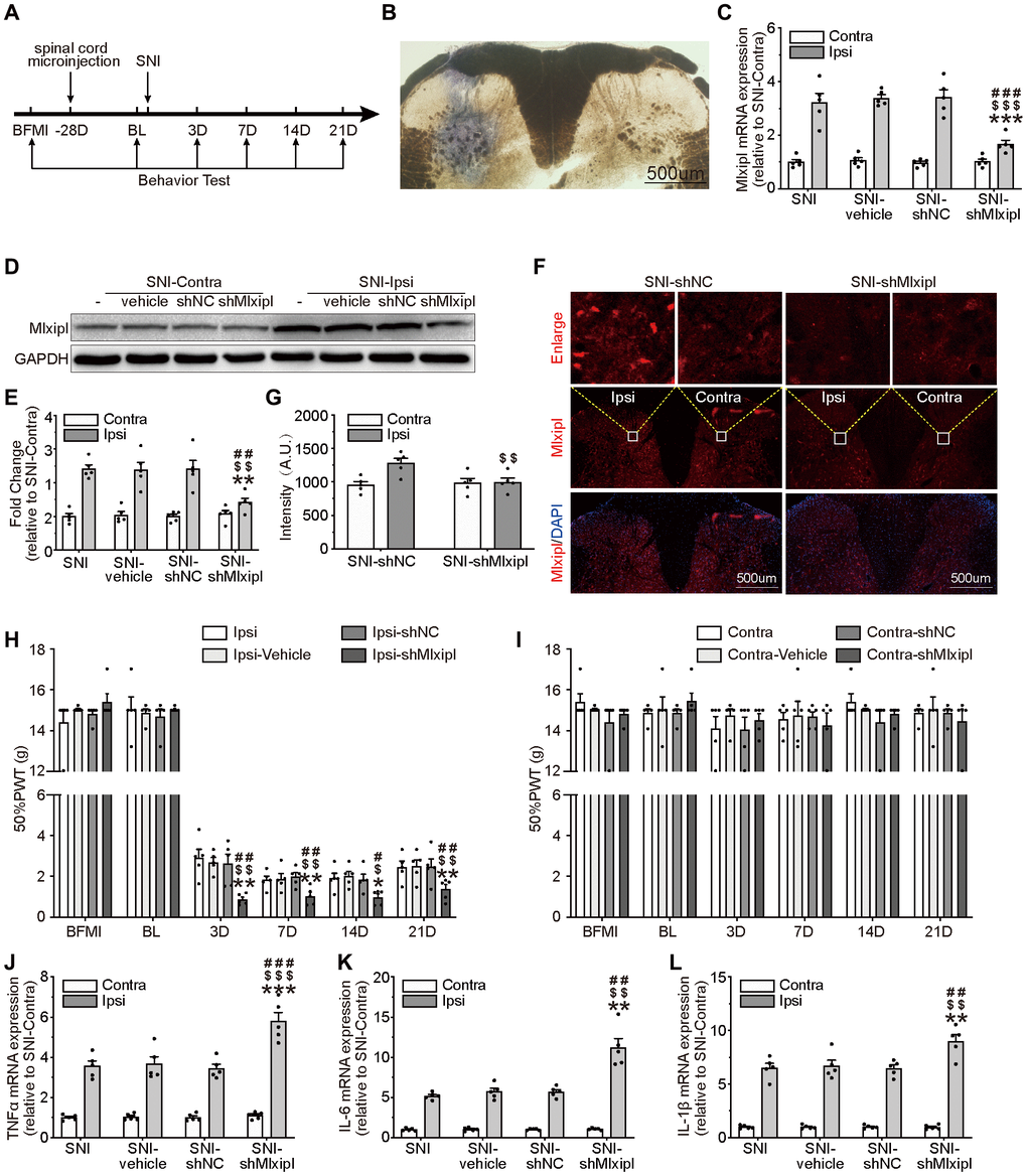 Knockdown of Mlxipl in the SDH promoted mechanical allodynia and neuroinflammation. (A) A schematic that illustrates the timing of the main experimental procedures. (B) The injection location was confirmed by intraspinal microinjection of trypan blue. (C–G) Mlxipl in the ipsilateral SDH was knockdown by intraspinal microinjection of shMLXIPL. SNI surgery was performed on day 28 after intraspinal microinjection. QPCR (C), western blot (D) and immunofluorescence (F) were performed at day 7 after SNI surgery. Quantification of western blot (E) and immunofluorescence (G). N = 5. ***P ###P ##P $$$P $$P H and I) Knockdown of Mlxipl promoted mechanical allodynia in the ipsilateral paw. The Von Frey test was performed before and after SNI surgery with or without pre-microinjection. N = 5. **P ##P #P $$P $P J–L) Knockdown of Mlxipl promoted neuroinflammation in the ipsilateral SDH. Proinflammatory cytokines were detected using qPCR at day 7 after SNI surgery. N = 5. ***P ###P $$$P 