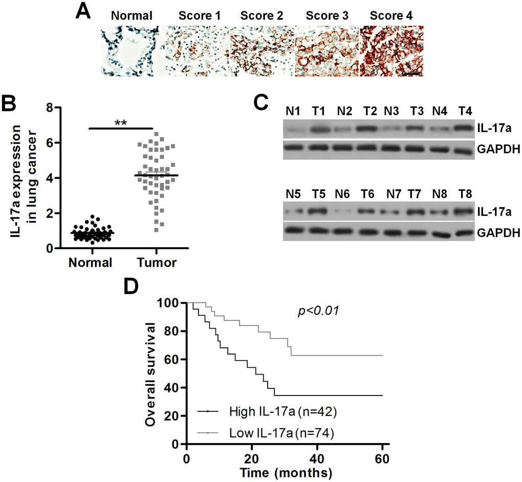 IL-17a expression is up-regulated in patients with lung cancer. (A) Images showing IL-17a expression levels in tumor samples from patients with lung cancer using IHC. Scale bar, 100 μm. (B) IL-17a expression levels in the primary lung tumor specimens and the adjacent normal tissue samples by RT-qPCR (n = 48). (C) Western blot analysis of IL-17a expression levels in the primary lung tumor specimens and the paired lung alveolar tissue samples (n = 8). (D) Kaplan-Meier survival curves for overall survival (OS) in lung cancer patients according to the expression levels of IL-17a. All data are expressed as mean ± SEM. **p.