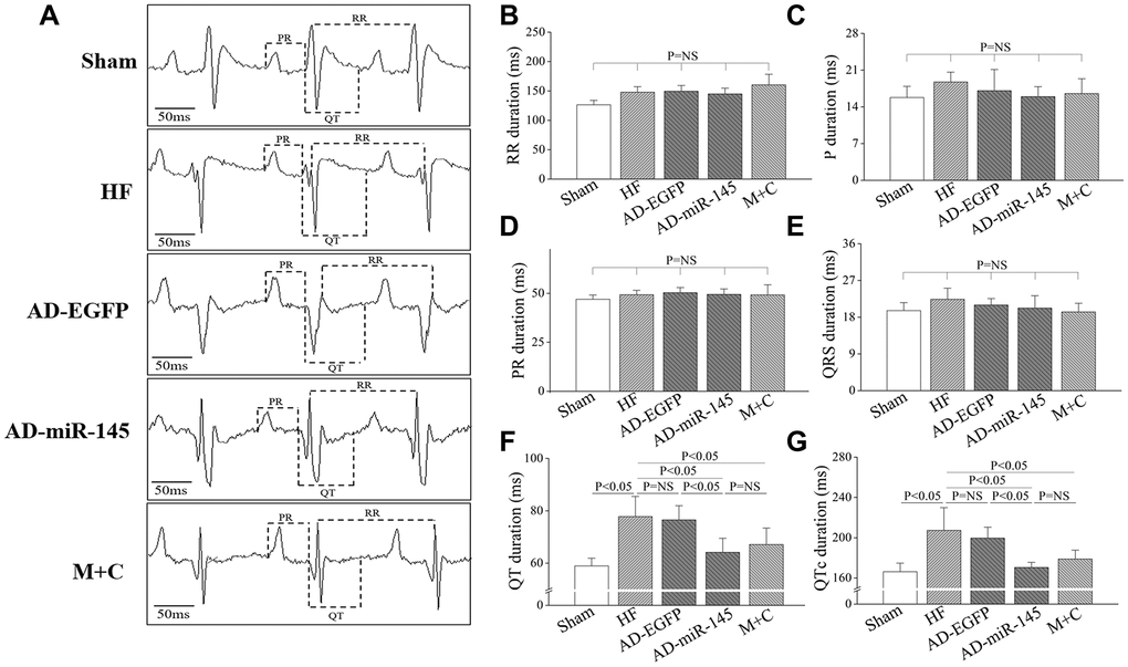 Characters of ECG parameters. (A), typical ECG recording after HF; (B–G), statistical results of P duration, RR interval, PR interval, QRS interval, QT interval and QTc interval (n=6). Data are presented as mean ± SD.