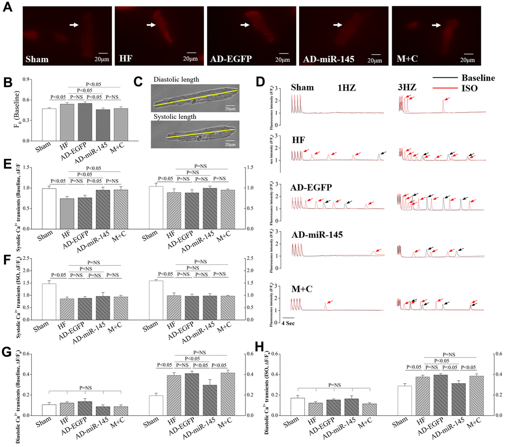 miR-145 ameliorated HF-induced defective in Ca2+ homeostasis. (A) representative imagines of resting fluorescence at baseline (The arrow marks cardiomyocyte stained with Rhod-2AM); (B) statistical analysis of F0 (n≥9); (C) representative imagines of cardiomyocytes sarcomere shortening from isolated HF hearts; (D) representative recording (F/F0) of steady-state Ca2+ transients followed by Ca2+ waves (The arrow marks Ca2+ wave); (E–H) statistical analysis of Ca2+ transients in systole and diastole (Baseline and in presence of ISO, n≥9); (I–J) statistical analysis of cell shortening (Baseline and in presence of ISO, n≥9). Data are presented as mean ± SD.