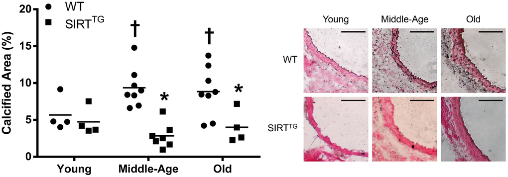 Calcified area relative to tunica media area in young, middle-age, and old wild-type (WT) and SIRT-1 transgenic overexpressing (SIRTTG) mice. Figure is accompanied by representative images. Black scale bars are equal to 100 μm. *P†P