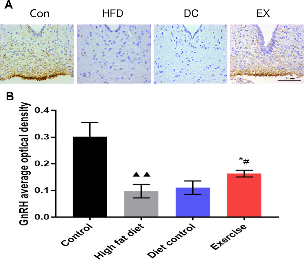 The GnRH expression levels in the hypothalamic arcuate nucleus. (A) GnRH positive expression in the brown area. The scale bar = 100 um. (B) The statistics of the GnRH average optical density value of each group. Image-Pro Plus 6.0 software was used to calculate the average optical density of GnRH. vs control group, ▲▲p * p ** p . vs DC group, #p ##p .