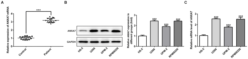 ANXA7 expression is increased in the serum of MM patients and MM cell lines. (A) The ANXA7 expression in the serum of MM patients was detected by RT-qPCR analysis. ***PB) The mRNA expression of ANXA7 in MM cell lines was detected by RT-qPCR analysis. ***PC) The protein expression of ANXA7 in MM cell lines was detected by Western blot analysis. ***P