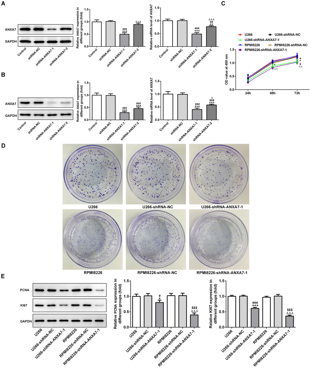 ANXA7 interference inhibits the proliferation of U266 and RPMI8226 cells. (A) The expression of ANXA7 in U266 cells after transfection of shRNA-ANXA7 was detected by Western blot and RT-qPCR analysis. **P##P###PΔΔΔPB) The expression of ANXA7 in RPMI8226 cells after transfection of shRNA- ANXA7 was detected by Western blot and RT-qPCR analysis. ***P###PΔPC) The proliferation of U266 and RPMI8226 cells after transfection of shRNA- ANXA7 was determined by CCK-8 assay. *P#PΔΔP$PD) The proliferation of U266 and RPMI8226 cells after transfection of shRNA- ANXA7 was also showed by colony formation assay. (E) The protein expression of PCNA and KI67 in U266 and RPMI8226 cells after transfection of shRNA-ANXA7 was detected by Western blot analysis. ***P###PΔΔΔP$$$P