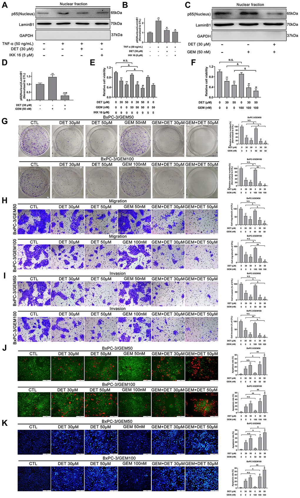 DET inhibited the TNF-α and GEM induced NF-κB activity and sensitized the antitumor effect of GEM in vitro. (A) DET inhibited TNF-α-induced NF-κB activity. (B) Quantitative statistics of immunoblotting assays for NF-κB-p65 levels. **P P C) DET inhibited GEM-induced NF-κB activity. (D) Quantitative statistics of immunoblotting assays for NF-κB-p65 levels. **P P E) Reduction of cell viability after 24 h combined treatment of DET and GEM, and IKK 16 and GEM in BxPC-3/GEM50 cell line. **P P P F) DET sensitized cells to the inhibitory effects of GEM on cell viability in BxPC-3/GEM100 cell line. **P P P G) DET enhanced the inhibitory effect of GEM on cell proliferation in GEM-resistant cell lines. **P P P P H, I) DET reinforced the suppression of GEM on the migration and invasion of GEM-resistant BxPC-3 cell lines. **P P P P J, K) DET amplifies the role of GEM in inducing apoptosis in GEM-resistant BxPC-3 cell lines. **P P P P H–K). Scale bar, 100 μm (H–K).