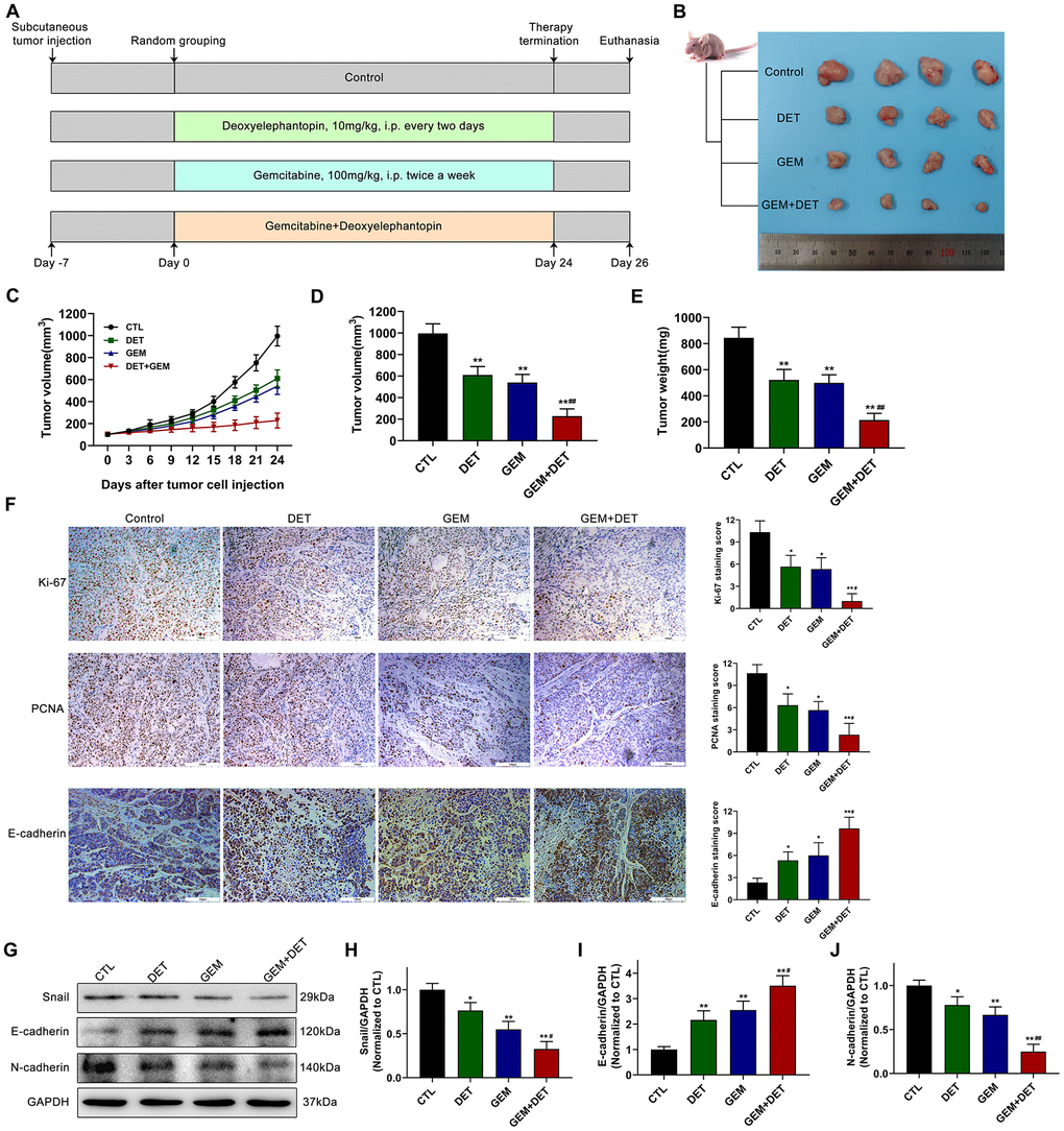 DET amplified the effect of GEM to inhibit the growth of pancreatic cancer in vivo. (A) The specific grouping strategies and treatment patterns of subcutaneous tumor model. (B) Xenograft tumors were established by subcutaneous injection of BxPC-3 cells (n = 4). (C, D) Curves of subcutaneous tumor volume in nude mice. **P P E) The final quantitative statistics of tumor weight. **P P F) Ki-67, PCNA and E-cadherin staining and quantitative statistics of the xenograft tumors were shown. *P P P G) EMT-related protein levels in tumor tissues were detected and quantified by western blotting. Quantitative statistics of western blotting analysis for Snail levels (H), E-cadherin levels (I) and N-cadherin levels (J). *P P P P F). Scale bar, 100 μm (F).