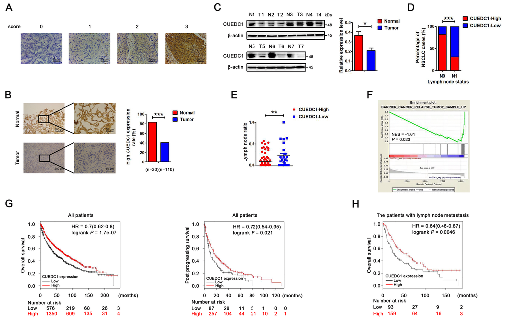 CUEDC1 expression in lung cancer tissues. (A) Immunohistochemical score of CUEDC1 expression in NSCLC and normal tissues. The staining intensity was scored with grades 0-3. (B) CUEDC1 expression examined by immunohistochemical analysis in 110 NSCLC patients, contained 30 pairs of NSCLC tumor tissues and their corresponding adjacent normal tissues, ***P C) CUEDC1 expression in fresh NSCLC tumor tissues (T) and matched normal tissues (N) examined by western blotting, *P D) Patients were classified in two groups, those with (N1) or without (N0) lymph node metastasis. IHC analysis showed that 31% of patients with lymph node metastasis had high CUEDC1 expression, whereas 82% of patients without lymph node metastasis had high CUEDC1 expression. P values were calculated using the χ2 test. (E) Analysis of the lymph node ratio (the ratio of the number of metastatic lymph nodes to the total number of examined lymph nodes) in NSCLC. P values were calculated using Student’s t-test. (F) The GSEA results showed a correlation between CUEDC1 levels and KEGG BARRIER CANCER RELAPSE TUMOR SAMPLE. (G) Kaplan-Meier survival curves of overall (left) and post progression survival (right) for high and low CUEDC1 expression levels. (H) Kaplan-Meier survival curves of overall survival comparing high and low CUEDC1 expression showed estimates of survival probability of lung cancer patients with lymph node metastasis using the Kaplan-Meier plotter database (219468