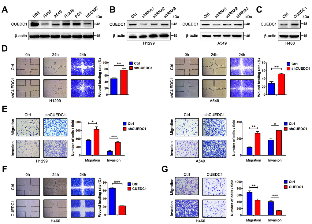 CUEDC1 decreases the motility and invasive properties of NSCLC cells. (A) CUEDC1 protein levels in different NSCLC cell lines and normal human bronchial epithelial cell line detected by western blotting. β-actin was used as an internal control. (B) CUEDC1 expression was confirmed by immunoblotting. CUEDC1 expression in H1299 and A549 cells was reduced markedly by shRNA1 interference. (C) Over-expression of CUEDC1 in H460 cells. CUEDC1 expression was determined using western blotting. (D) Wound-healing assays were used to investigate the migration of H1299 and A549 cells. P values were calculated using Student’s t-test. (E) Migration and invasion of H1299 and A549 cells (and their derivatives) were measured using transwell assays. P values were calculated using Student’s t-test. (F) Wound-healing assays were used to examine the migration of H460 cells. P values were calculated using Student’s t-test. (G) The migration and invasion of H460 cells (and their derivatives) were performed using transwell assays. The data are expressed as the mean ± SEM. P values were calculated using Student’s t-test; *P P P 