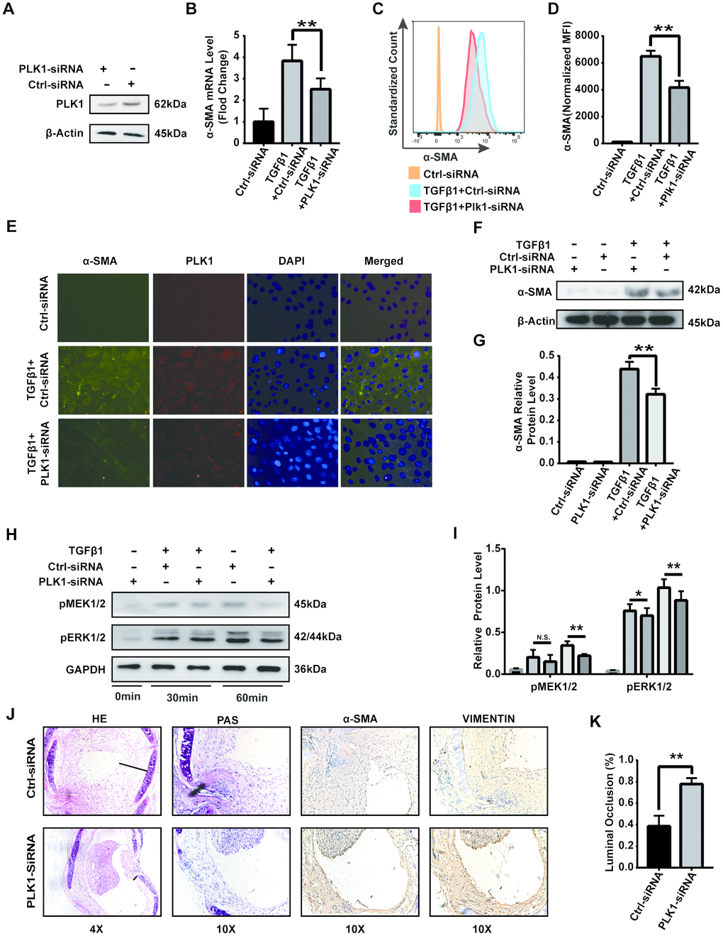 PLK1 siRNA suppresses differentiation of myofibroblasts in vitro and in vivo. (A) Protein expression of PLK1 following siRNA transfection. (B) The mRNA expression of α-SMA following PLK1 siRNA transfection. (C, D) The expression of α-SMA was measured by FCM; quantification by MFI analysis is shown in the bar diagram. (E) The expression of α-SMA was analyzed by IF. (F, G) The expression of α-SMA was analyzed by WB. (H, I) Representative immunoblots for MEK, phosphorylated ERK, and GAPDH at various timepoints are shown. (J) Representative immunohistochemical stains of PLK1 siRNA-treated or control tracheal grafts 28 days post-transplantation. (K) Percentage of luminal occlusion in the PLK1 siRNA-treated and control groups 28 days after transplantation.