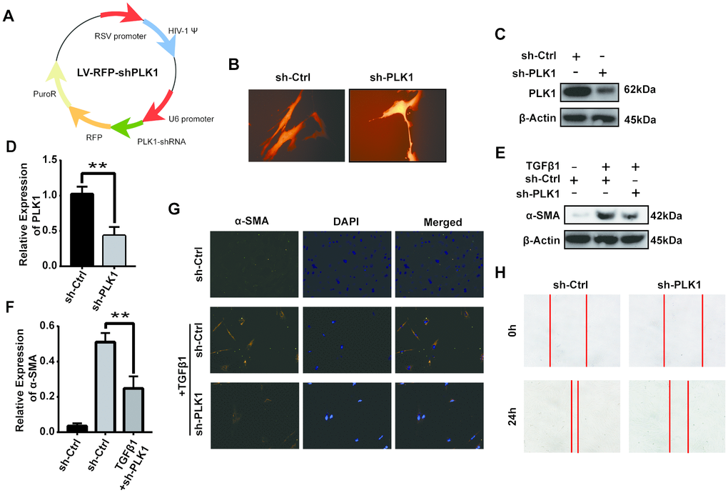 PLK1 knockdown inhibits TGFβ-mediated differentiation of human myofibroblasts. (A) Schematic depicting establishment of the recombinant plasmid RSV-PLK1-shRNA. (B) A representative image of infected human primary myofibroblast cells. (C–F) The expression of [50] α-SMA was analyzed by WB (C, D), qRT-PCR (E, F), and IF (G). (H) Migration ability of myofibroblasts in the control and PLK1-shRNA-treated groups.