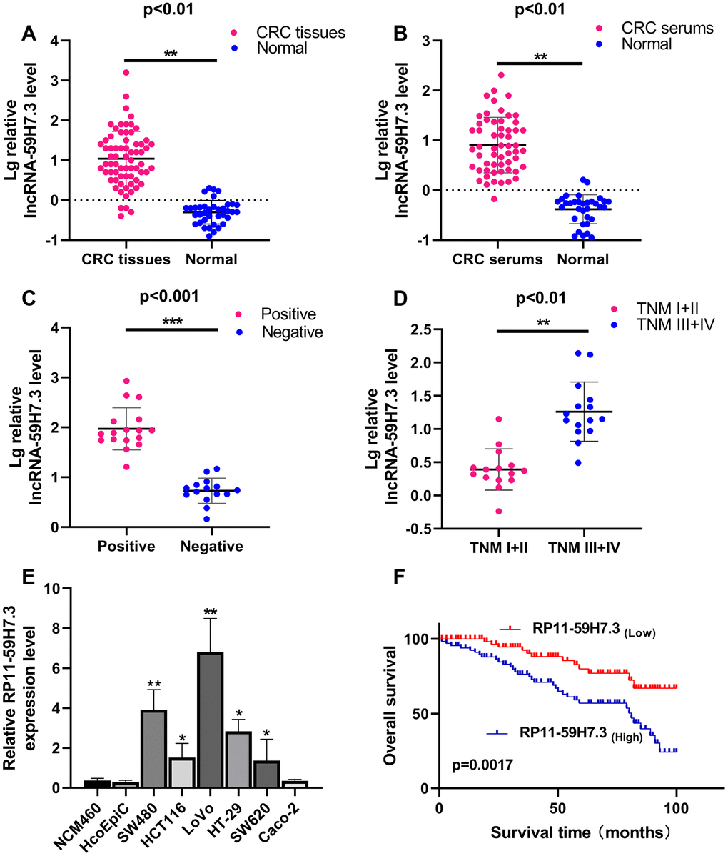 RP11-59H7.3 is upregulated in tumor tissues, serums and cell lines of CRC. (A) Relative expression levels of RP11-59H7.3 in 68 paired CRC and paired adjacent healthy tissues were quantified by RT-qPCR. (B) Relative expression levels of RP11-59H7.3 in 57 CRC serums and negative control sera were quantified by RT-qPCR. (C, D) Relative RP11-59H7.3 expression in the CRC patients for lymph node positive, lymph node negative and stage I+II, stage III+IV. (E) Relative RP11-59H7.3 expression in CRC cell lines (SW480, HCT116, LoVo, HT29, SW620, Caco-2) compared to normal colonic epithelial cell line NCM460 and HcoEpic. (F) Kaplan-Meier survival analysis of the overall survival in two groups defined by low and high expression of RP11-59H7.3 in patients with CRC. ***p p p 