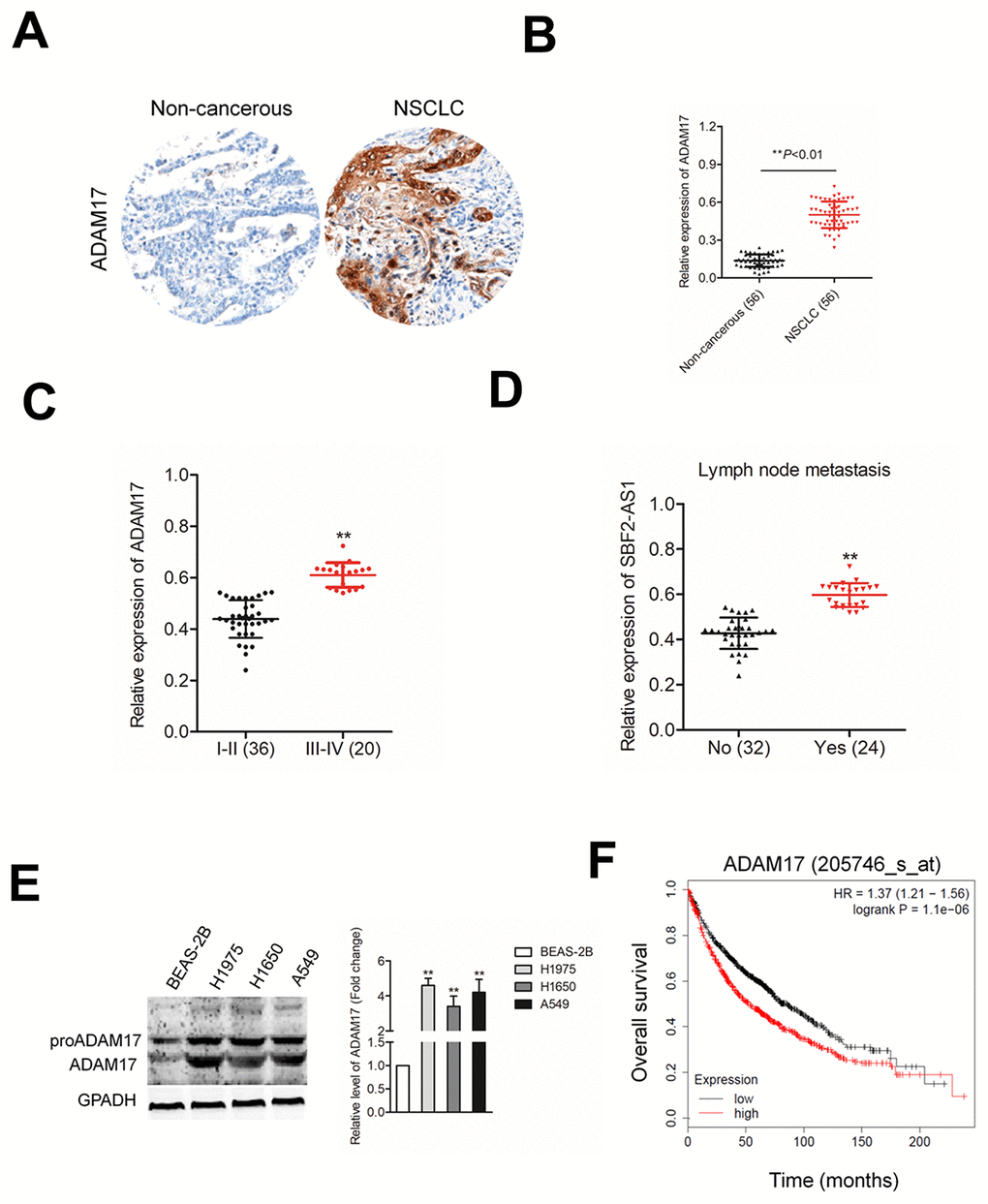 ADAM17 is overexpressed in NSCLC. (A) IHC staining of ADAM17 in NSCLC and non-cancerous tissue. (B) qRT-PCR analysis of ADAM17 expression in NSCLC tissues and non-cancerous tissues (C) The expression levels of ADAM17 in patients with different stage. **PD) The expression levels of ADAM17 in patients with or without metastasis. **PE) Western blotting analysis of ADAM17 expression in human bronchial epithelial cell BEAS-2B and NSCLC cell lines (A549, H1650 and H1975). **PF) High ADAM17 was a predictor for poor overall survival of NSCLC patients as analyzed using Kaplan-Meier plotter website.