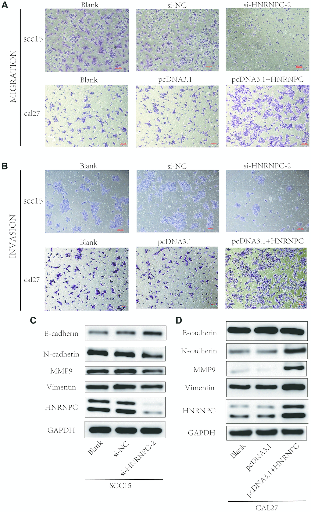 Detection of migration and invasion abilities. (A, B) Migration and invasion abilities were detected in scc15 cell line and cal27 cell line. Overexpression of HNRNPC promoted OSCC cells migration and invasion, and it was oppositely in knockdown of HNRNPC. (C, D) EMT markers were detected with Western bolt assay. Activation of EMT pathway accelerated the migration and invasion of OSCC.