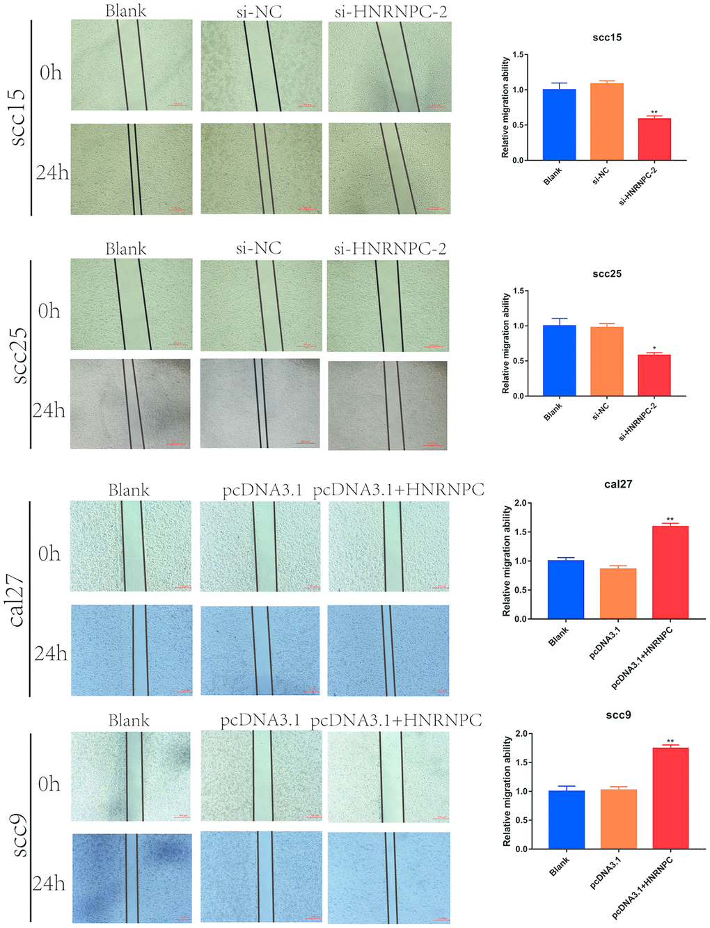 Scratch wound healing assay in OSCC cell lines. Scratch wound healing assay were used to evaluate the migration of scc15 cell line (A, p= 0.0079), scc25 cell line (B, p= 0.0136), cal27 cell line (C, p= 0.0068) and scc9 cell line (D, p= 0.0066).