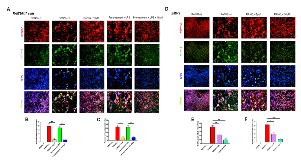 Epothilone B made an inhibitory effect on osteoclast fusion significantly. (A) Representative images of FAK staining of RAW264.7 cells induced by RANKL or LPS with or without Epothilone B treatment. Scale bar = 200 μm. (B–C) Quantitative analysis of multinucleated osteoclasts (nuclei≥3) and average the number of multinucleated osteoclasts. (D) Representative images of FAK staining of BMMs induced by RANKL in the presence or absence of various concentrations of Epothilone B. Scale bar = 200 μm. (E–F) Quantitative analysis of multinucleated osteoclasts (nuclei≥3) and average the number of multinucleated osteoclasts. Data in the figures represent mean ± SD. *p 