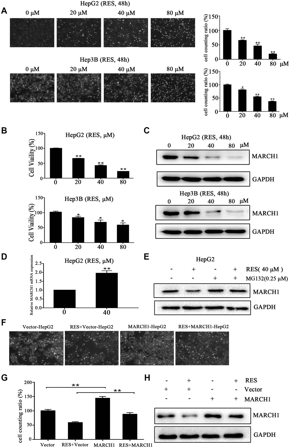 Resveratrol inhibits HCC cell viability. (A) Representative images of HepG2 and Hep3B cells treated with different concentrations of resveratrol for 48 h. (B) The cytotoxicity of HepG2 and Hep3B cells treated with resveratrol was estimated by CCK-8 assays. HepG2 and Hep3B cells were treated with different concentrations of resveratrol for 48 h. The absorbance at 450 nm is detected. (C) Western blot analysis showed that MARCH1 expression decreased after resveratrol treated for 48 h in both HepG2 and Hep3B cells. GAPDH was also detected as the loading control. (D) HepG2 cells were treated with the indicated dose of resveratrol for 24h and then analyzed the transcription level of MARCH1. MARCH1 mRNA levels were normalized to GAPDH. (E) HepG2 cells were pretreated with 0.25μM MG132 for 24h, then analyzed the expression of MARCH1. (F, G) HepG2 cells were treated with the indicated dose of empty vectors and overexpression plasmids for 48h, then incubation with resveratrol for 24h. (H) The expression of MARCH1 were detected. All values represent the mean ± SD. **P 