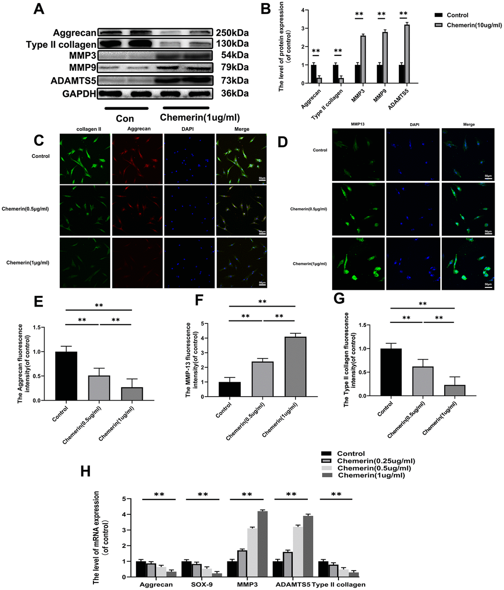 Effect of chemerin on anabolism, and catabolism of ECM in human NPCs. (A) The expression levels of aggrecan, collagen II, MMP3, MMP9, and ADAMTS5 were visualized by western blotting. (B) Quantification of Aggrecan, collagen II, MMP3, MMP9, and ADAMTS5 immunoblots. (C, D) The expression levels of collagen II, aggrecan, and MMP-13B were observed by immunofluorescence, and (E–G) the fluorescence intensity analyzed using Image J. (H) The mRNA expression levels of aggrecan, SOX-9, MMP3, ADAMTS5, and collagen II in NPCs were evaluated by RT-PCR. Data are represented as mean ± SEM of three independent experiments, each done in triplicate. Significant differences between groups are indicated as **p 